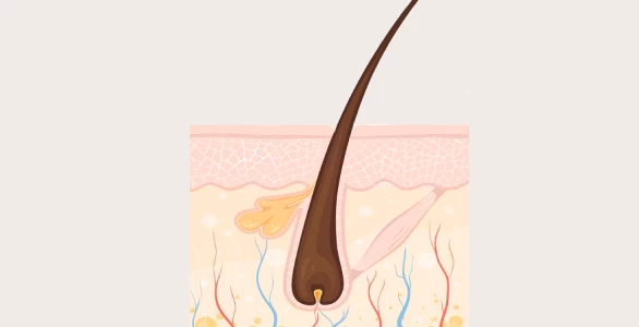 What is Normal Hair Loss in Women?