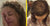The Link Between Stress and Hair Loss in Women