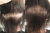 Hair Loss in Women During Menopause