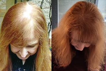 folliboost hair growth serum results